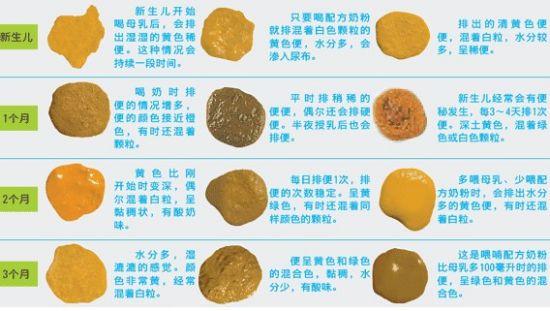 婴儿大便颜色可反映身体状况,宝宝是否健康,宝