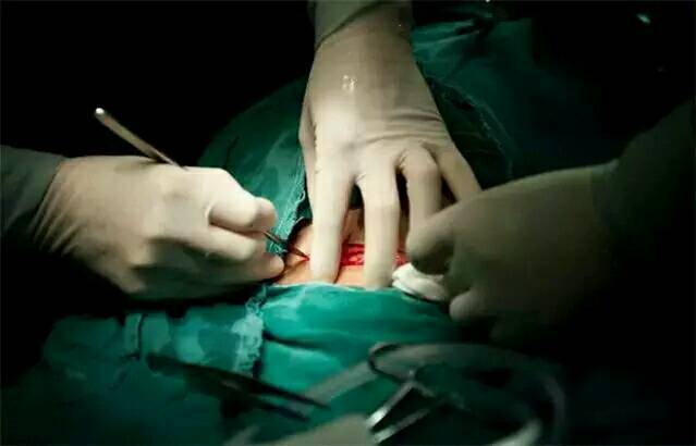 100张照片,100%还原"剖腹产"全过程!(有图慎入)