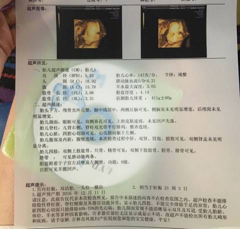 journal_insert_pic_545194324
