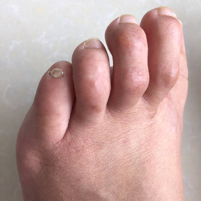 忽然这几天起来好多小红疙瘩跟小米粒似的～有类似经历的吗?