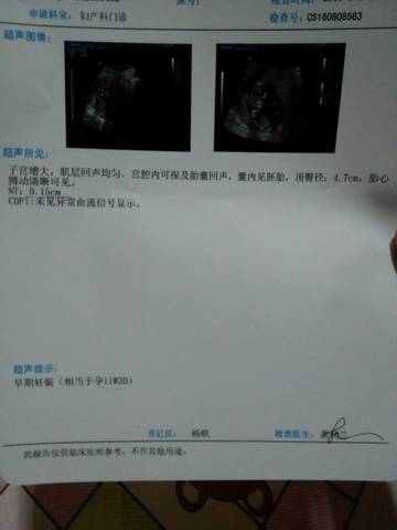 journal_insert_pic_547190687