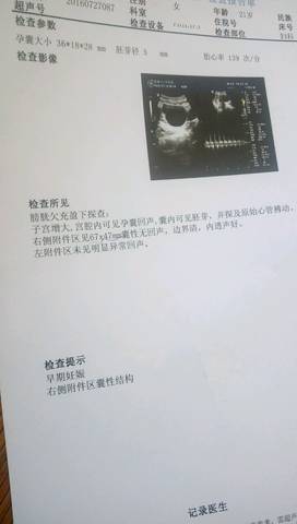 journal_insert_pic_547230001