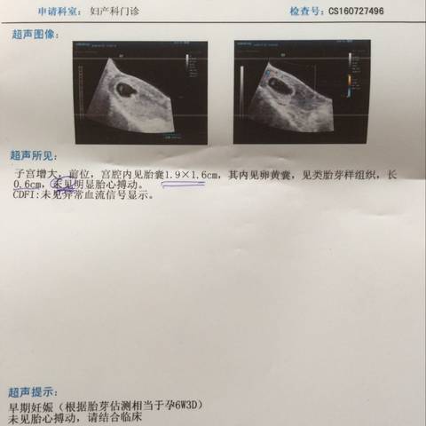 journal_insert_pic_547733130