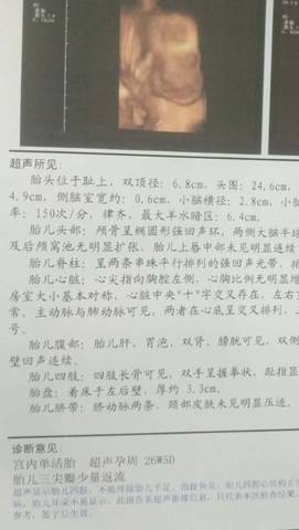 journal_insert_pic_547533912