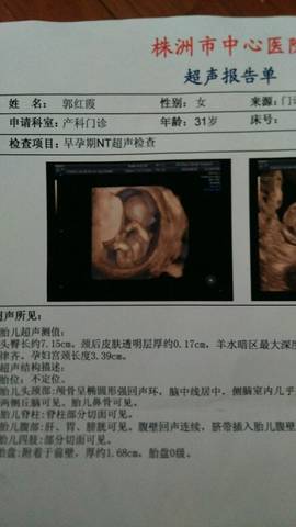 三个月胎儿四维彩超图片