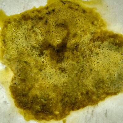 我家三个月的宝宝吃母乳拉稀绿色的还有沫沫,吃着妈咪爱也不见好,怎麼