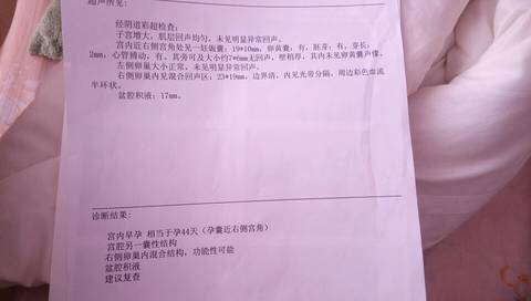 journal_insert_pic_549632814
