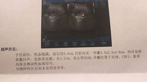 journal_insert_pic_551047475