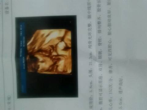 journal_insert_pic_554555581
