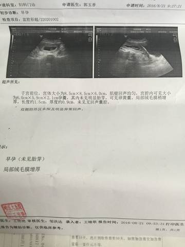 journal_insert_pic_556570292