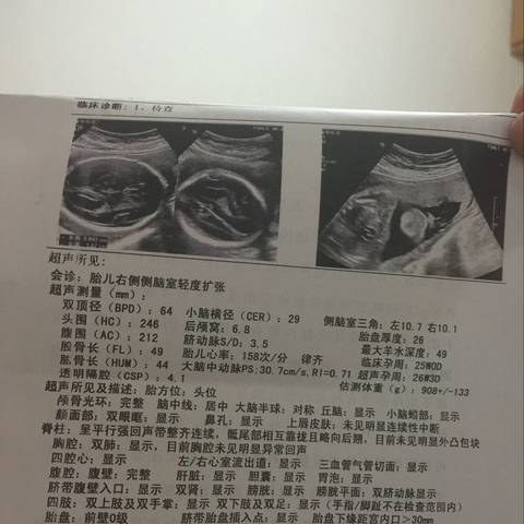 journal_insert_pic_559459280