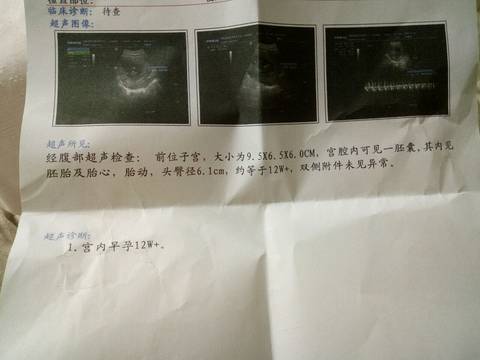 journal_insert_pic_559302222