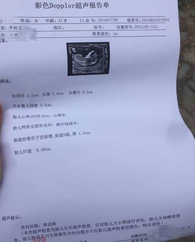 journal_insert_pic_559062375