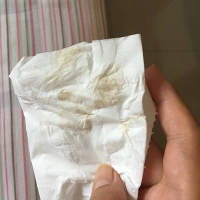 上月17号的月经,昨晚有点这样的分泌物,颜色不深,只有小便后有一丁点