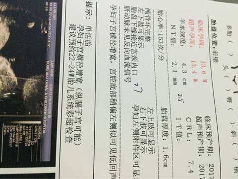 journal_insert_pic_560989120