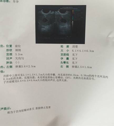 journal_insert_pic_561823767