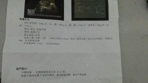 journal_insert_pic_563896566