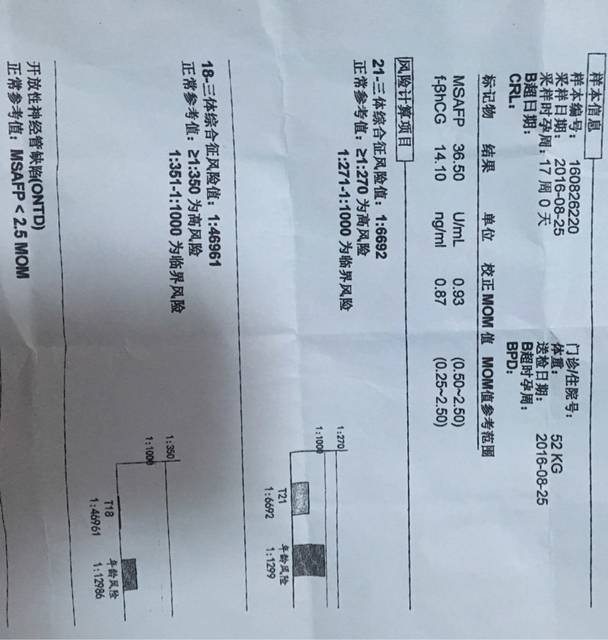 唐筛单子看男女准确率75%