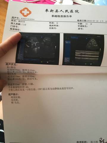 journal_insert_pic_565451460