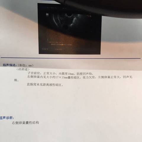 journal_insert_pic_566059044