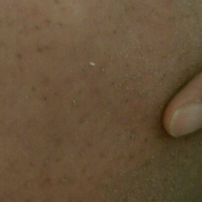 宝宝后背,手臂后侧长黑点点,看起来像灰,摸起来