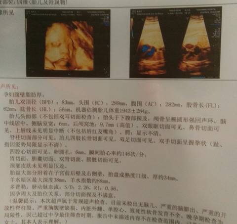 journal_insert_pic_572030452