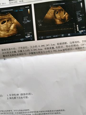 journal_insert_pic_572532849