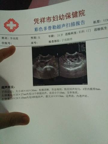 journal_insert_pic_574641144