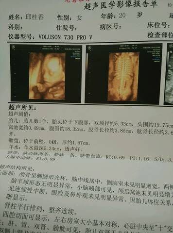 journal_insert_pic_575460634