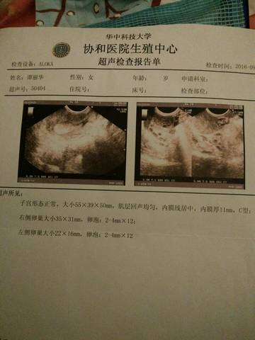 journal_insert_pic_577221330