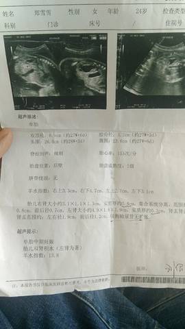 journal_insert_pic_577410826