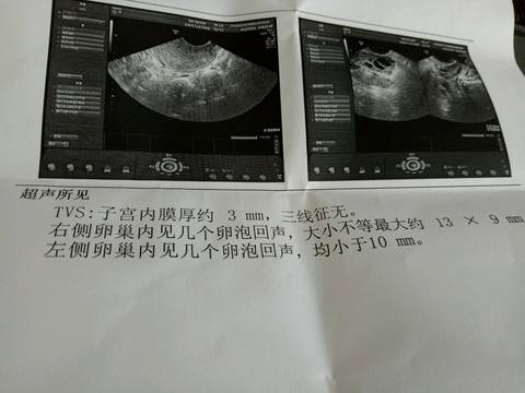 journal_insert_pic_577939430