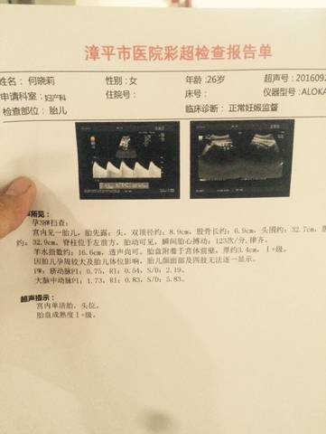 journal_insert_pic_578874735