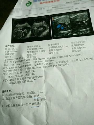 journal_insert_pic_580954231