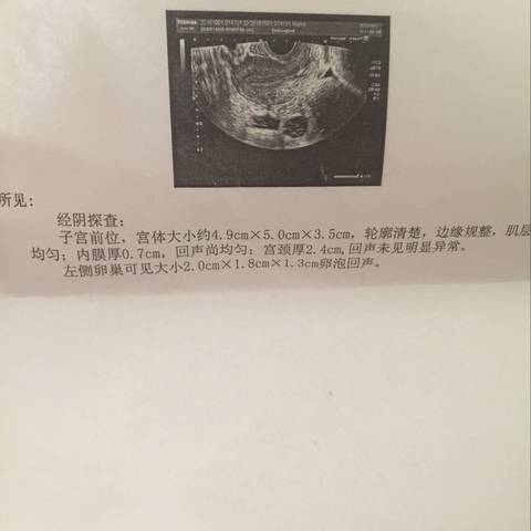 journal_insert_pic_581121226