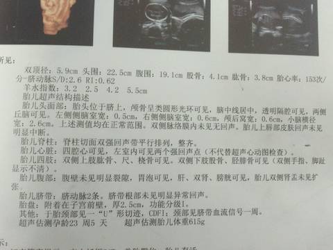 journal_insert_pic_581627406