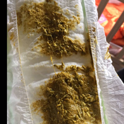 我家宝宝38天了,最近这两天母乳和奶粉搭配着喂的,大家帮忙看看大便