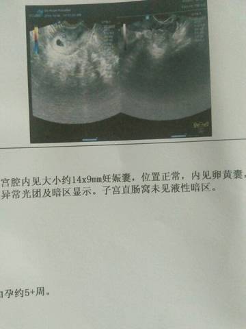journal_insert_pic_585180954