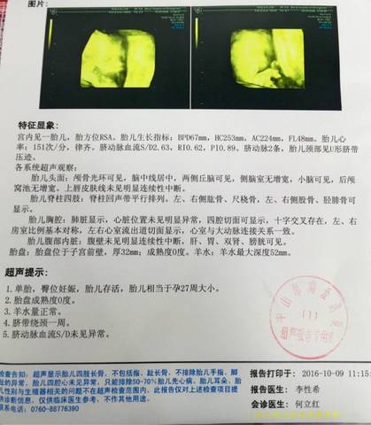 journal_insert_pic_586542016
