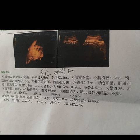 journal_insert_pic_587255862
