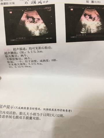 journal_insert_pic_586995665