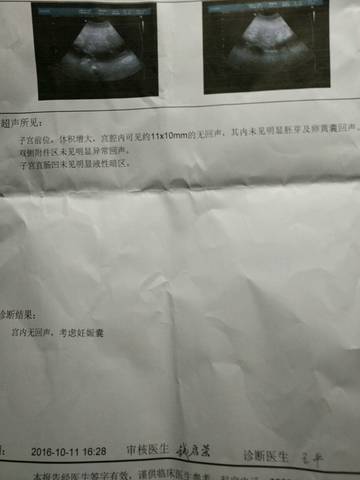 journal_insert_pic_587866313