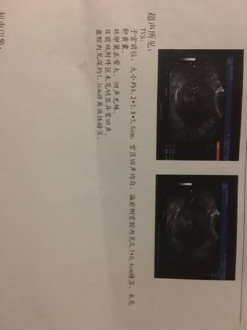 journal_insert_pic_588008376