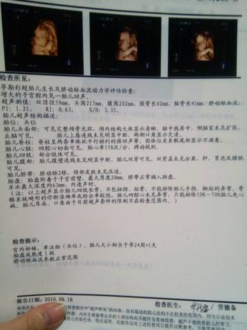 journal_insert_pic_588593071