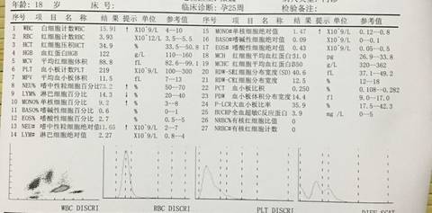 journal_insert_pic_588811853