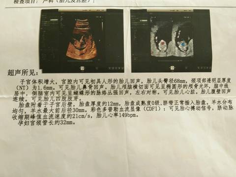 journal_insert_pic_589358337