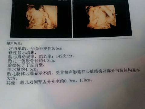 journal_insert_pic_590382061