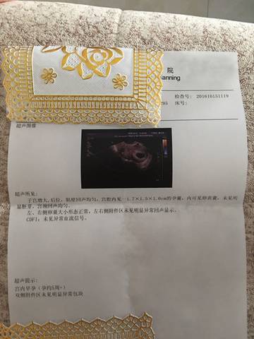 journal_insert_pic_590442188