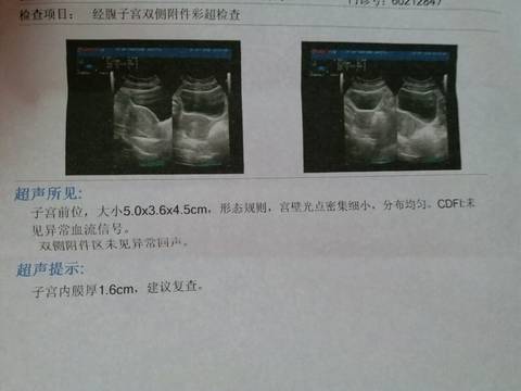 journal_insert_pic_591146779