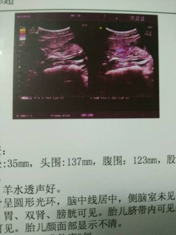 journal_insert_pic_591889484